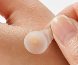 Hydrocolloid patch filled with fluid